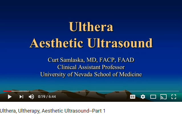 Ulthera, Ultherapy Videos