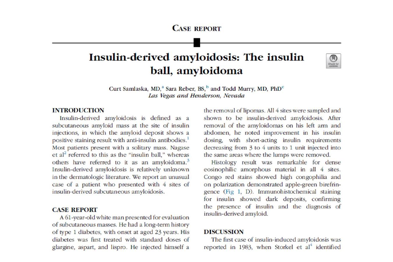 Insulin-Derived Amyloidosis, The Insulin Ball, Amyloidoma:  A Closer Look…