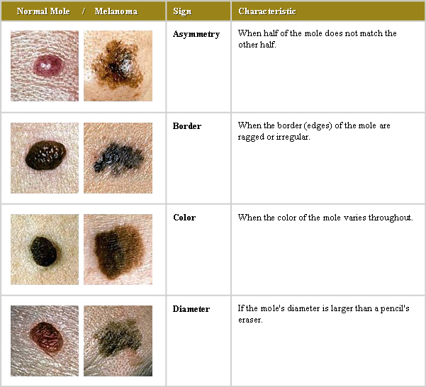 ABCDChart - Academic Dermatology of Nevada