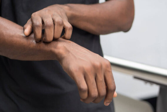 4 Ways to Prevent Dry Skin This Fall