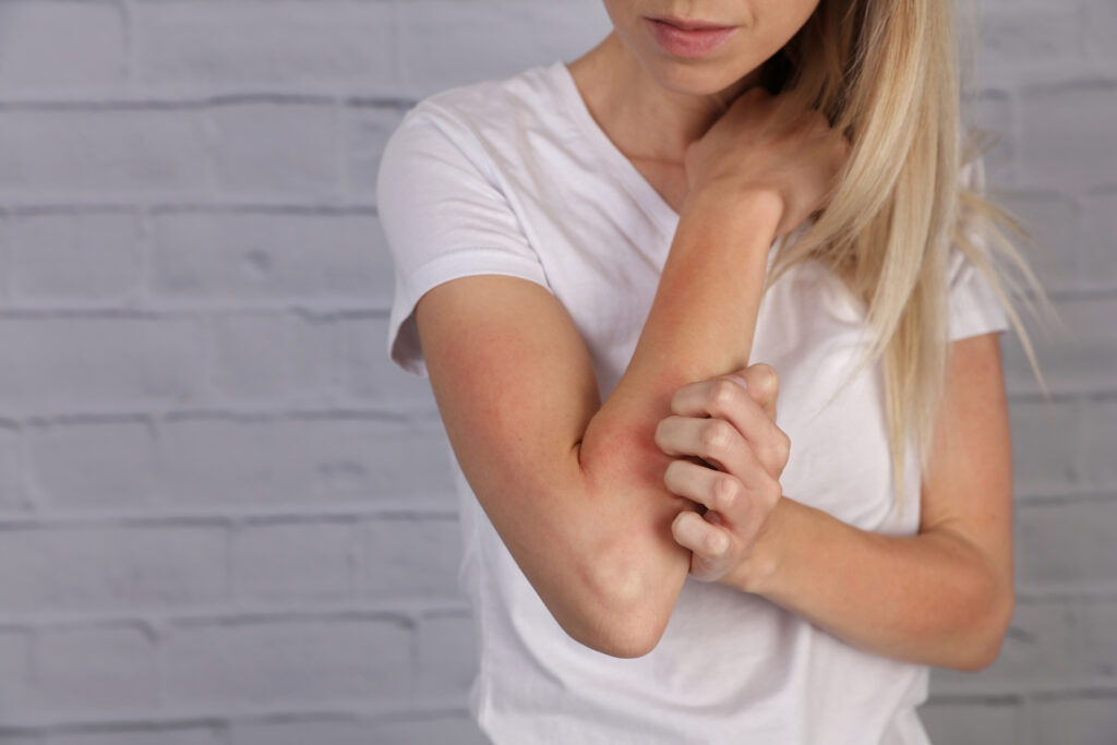 Woman Scratching an itch Sensitive Skin Food allergy symptoms Irritation - Academic Dermatology of Nevada