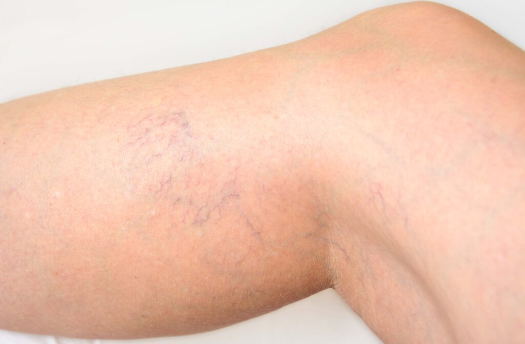 AdobeStock_373133687 - Academic Dermatology of Nevada